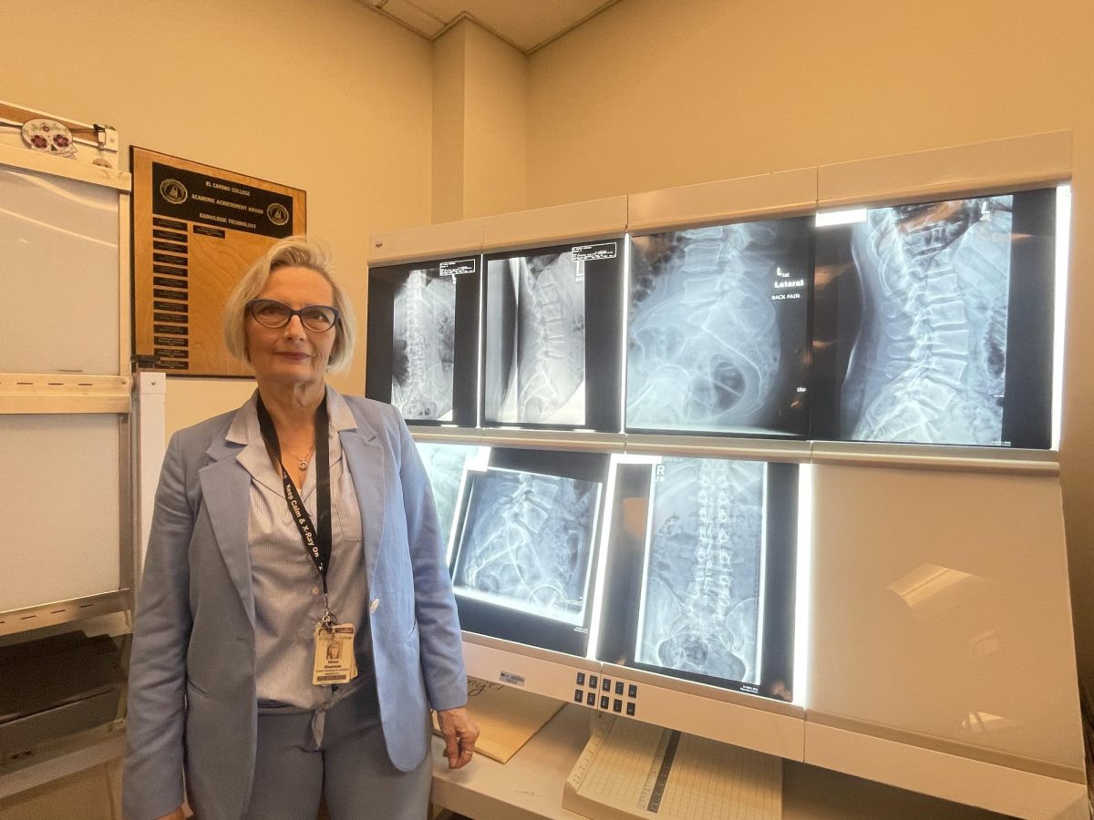 Dawn Charman, 67, radiologic technology program director and coordinator in front of displays of x-ray scans on Monday, Dec. 11. The scans are used in the radiologic technology classroom, located in the Math Business and Allied Health Building. (Emily Gomez | The Union)